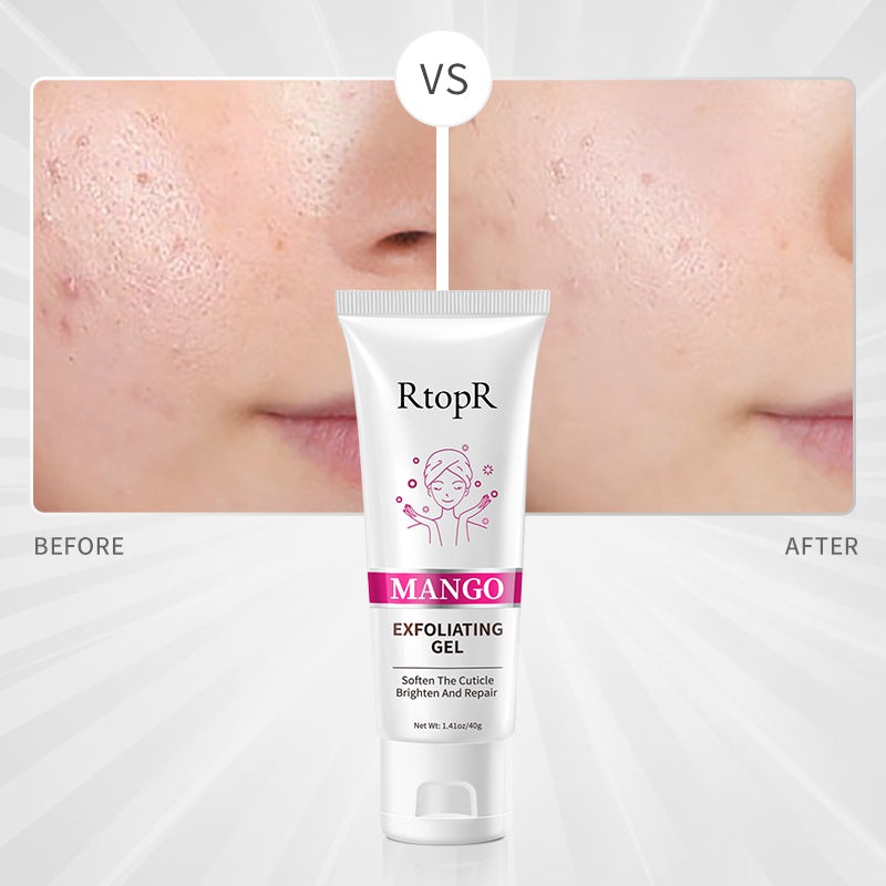 RtopR Mango Exfoliating Gel