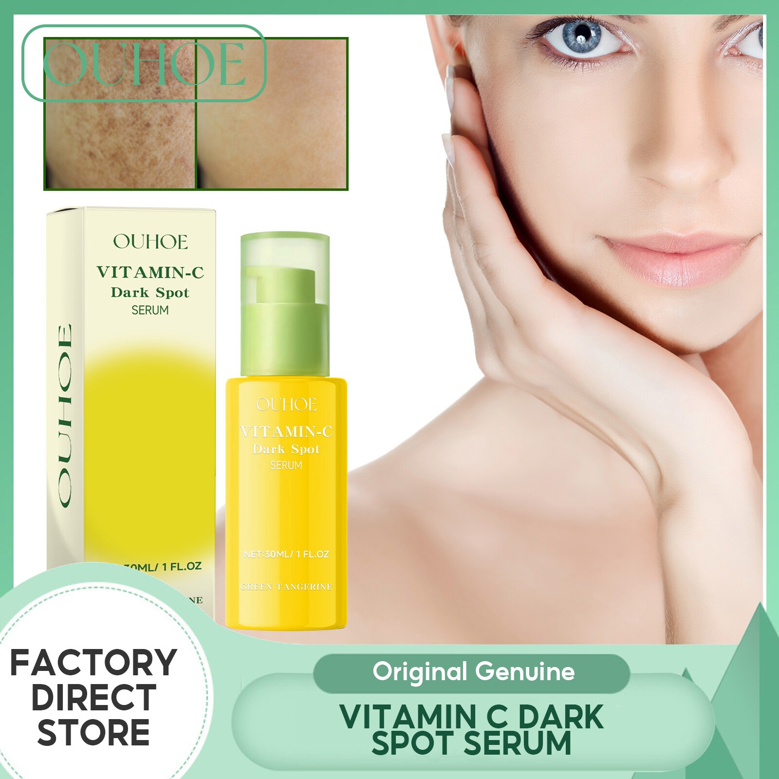 Ouhoe Vitamin C Dark Spot Serum