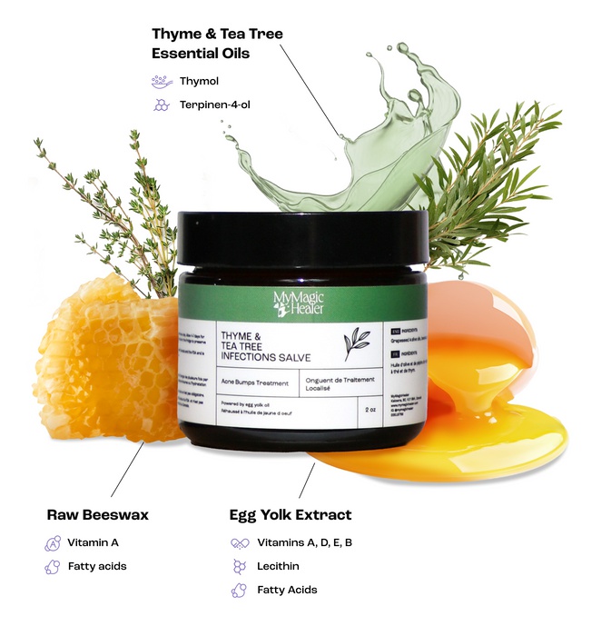 My Magic Healer Thyme & Tea Tree Infections Salve | Acne Bumps Treatment