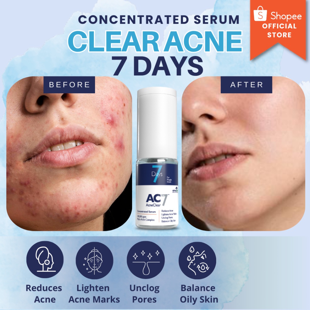 Acneclear 7 Days