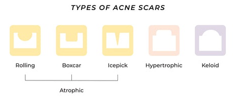 Ingredients For Scars